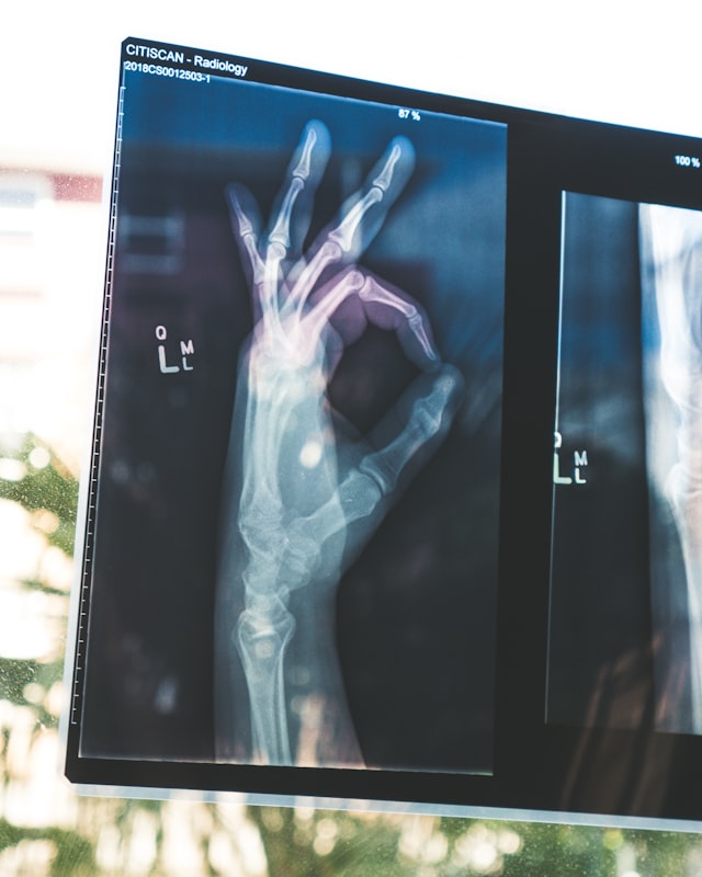 Diagnostic imaging related to abdominal health
